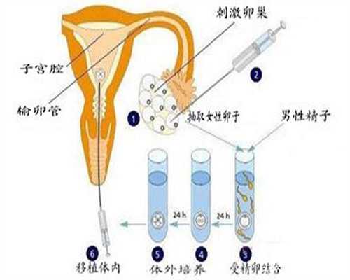 婴儿腹泻时切勿自行用药的正确处理方法