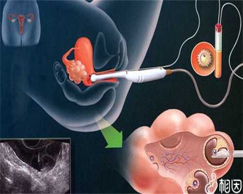 宝宝腹泻期间能否食用鱼类?营养与消化解析
