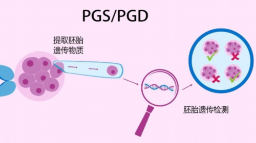 江苏助孕宝宝眼屎多的可能原因解析